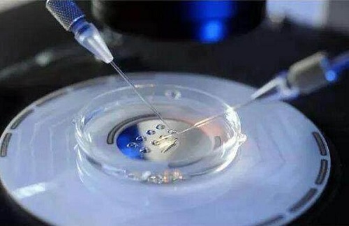 试管婴儿移植鲜胚是有条件的