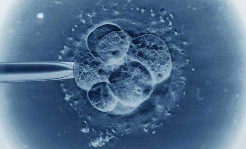 试管婴儿一次能成功吗？为什么别人一次就能成功？