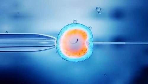 美国试管婴儿做胚胎基因检测，是否需要额外收费？