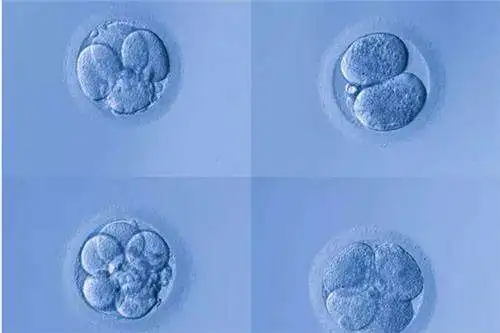 试管婴儿全过程、流程你还不知道吧？