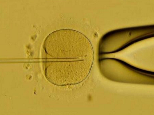 美国试管婴儿提高卵子太“老”人群成功率