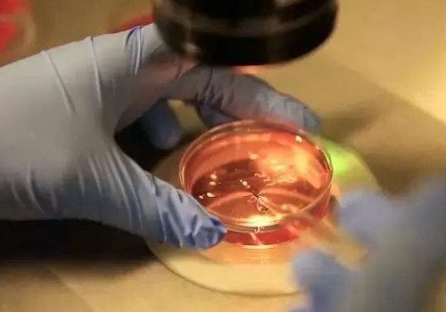 试管婴儿价格多少？需要多少费用？