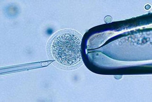 泰国试管放2个胚胎的成活率和啥有关？
