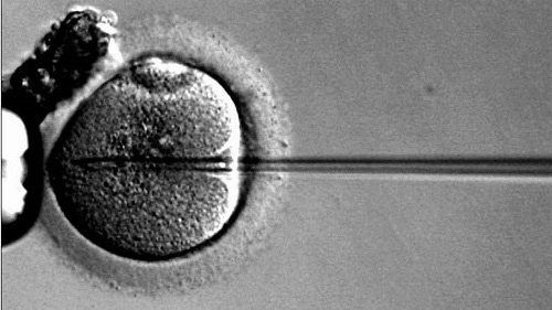 试管婴儿养囊一个多钱？染色体异常能做吗？